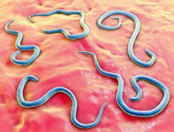 Mengenal Cacing Gelang, Parasit yang Bisa Bertelur 100.000 Butir, Hidup di Usus Manusia